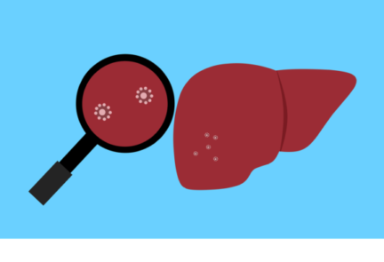 Kemenkes RI Imbau Masyarakat Waspada Virus Hepatitis Misterius